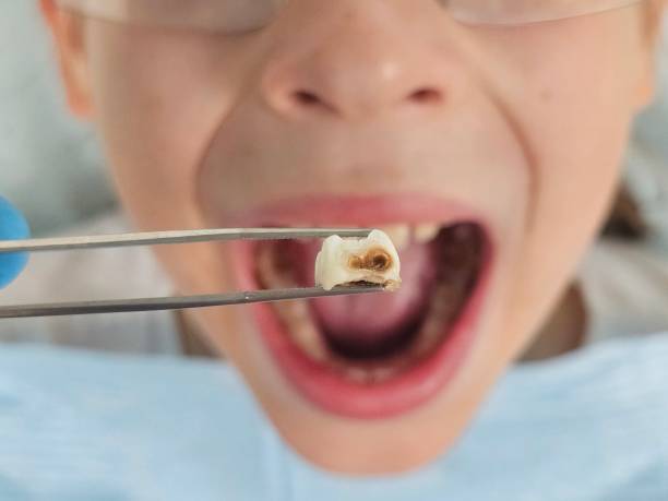 Best Weekend Emergency Dentist in Dillon, SC